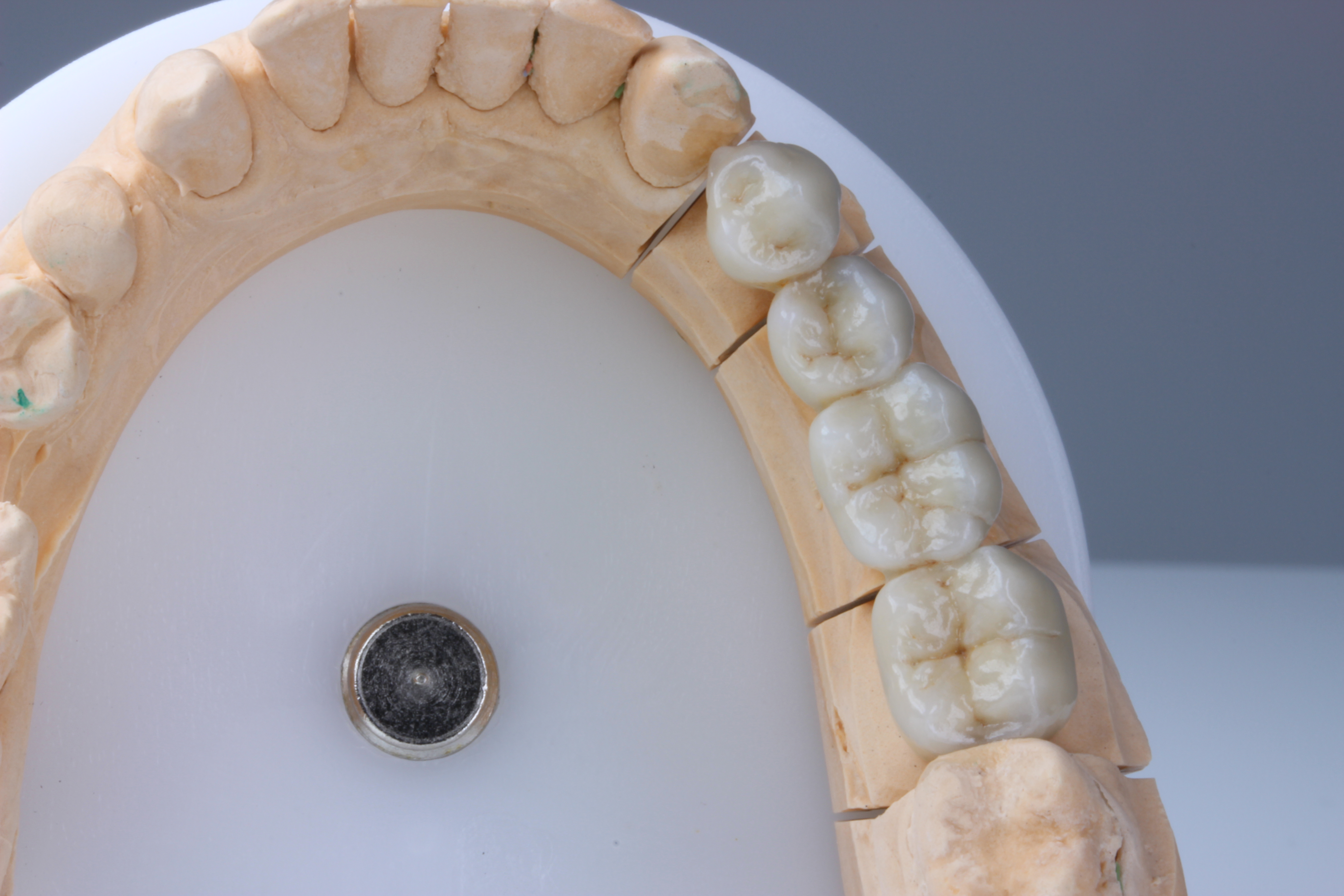 denti